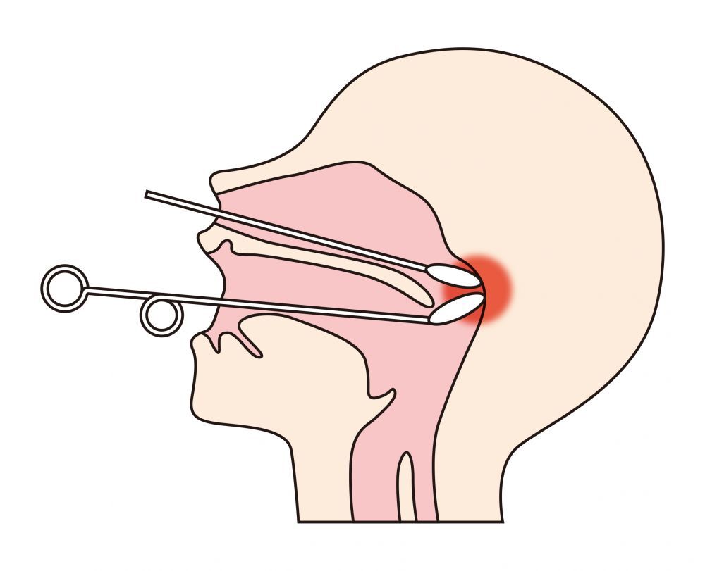 小児耳鼻咽喉科
